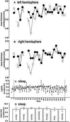 Interaction of Sleep and Cortical Structural Maintenance From an Individual Person Microlongitudinal Perspective and Implications for Precision Medicine Research